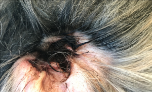 Mioritic clinical aspects in external otitis