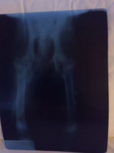 radiografie cornel 2.jpg